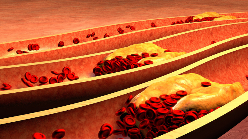 THE IMPORTANCE OF KNOWING THE DIFFERENCE BETWEEN ”GOOD AND BAD CHOLESTEROL